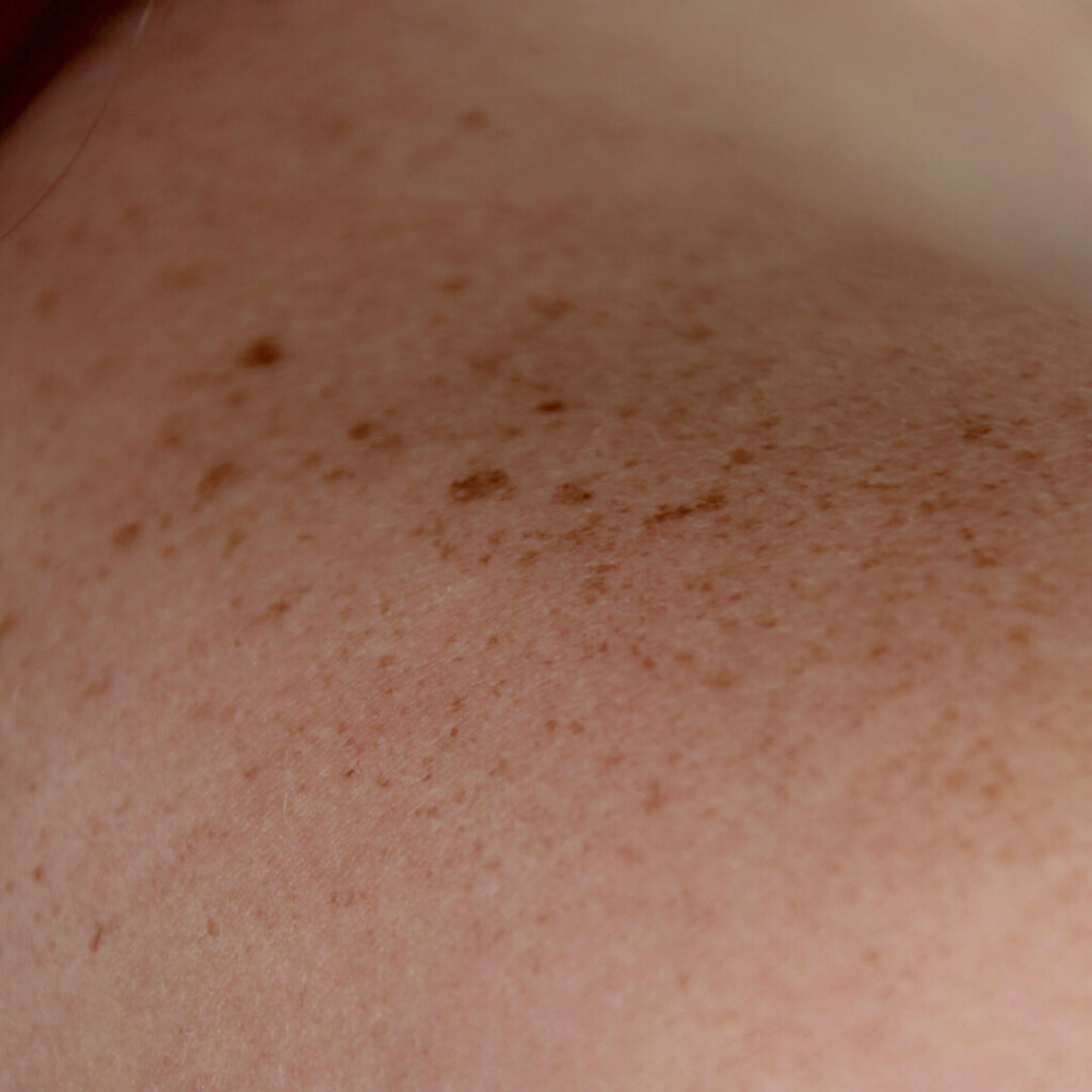 Oda-fotos-web-optimizadas-2